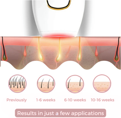 Glowa - Permanent Hair Removal Device